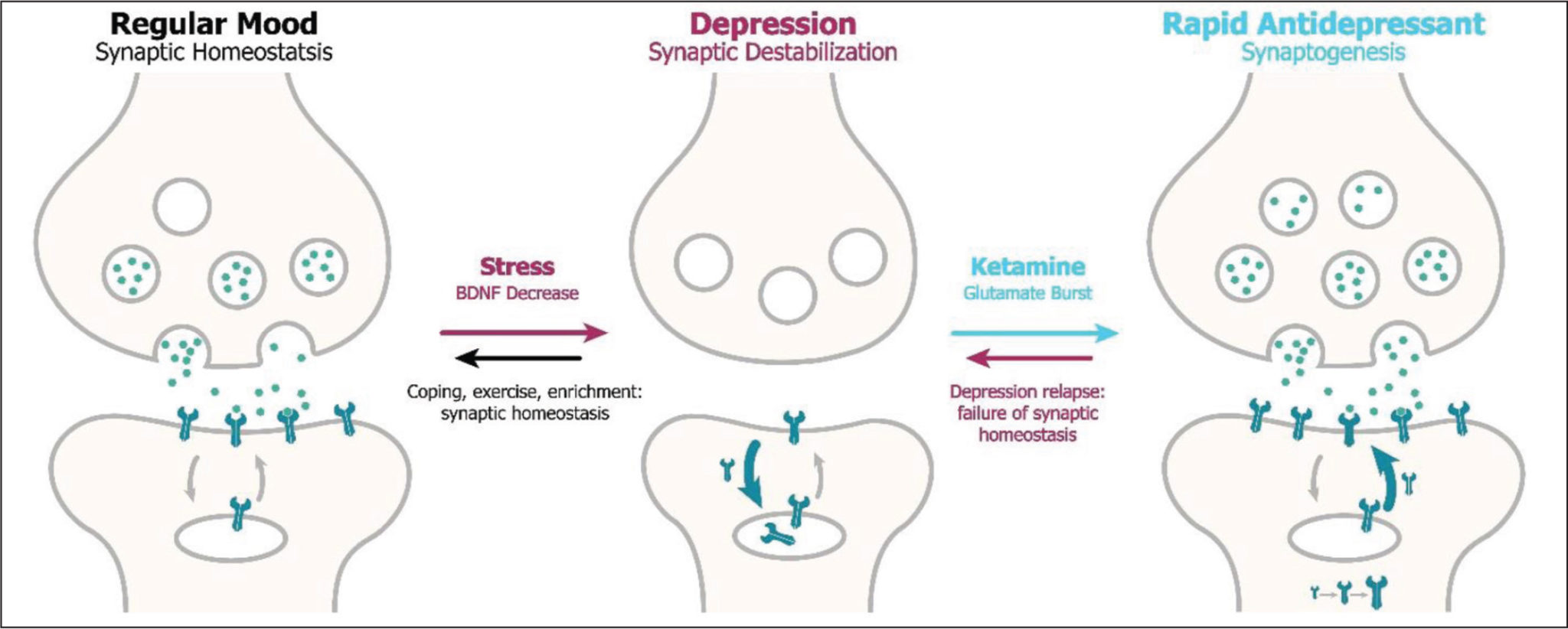 Ketamine Infusion Therapy - Awakenings KC